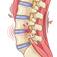 Lower Back